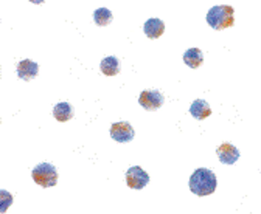 IHC-plus™ Polyclonal Rabbit anti-Human BIK Antibody (IHC, IF, WB)