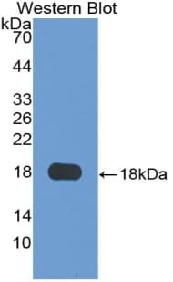 GRN / Granulin Antibody (aa21-120)