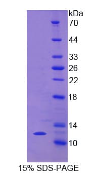 Horse CCL5 / RANTES Protein (Recombinant His)