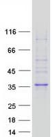 Human FAM78A Protein (Recombinant Myc-DDK (Flag))