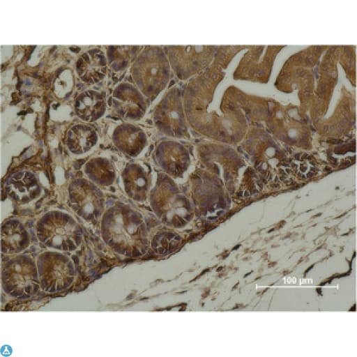 ACTC1 / Alpha Cardiac Actin Antibody