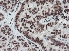TPRKB Antibody (clone OTI3H3)