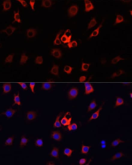S100A4 / FSP1 Antibody