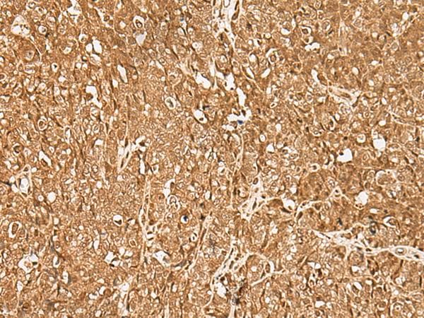 Polyclonal Rabbit anti-Human GMEB2 Antibody (IHC)