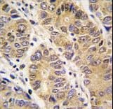 Polyclonal Rabbit anti-Human MMP13 Antibody (aa295-324, IHC, WB)