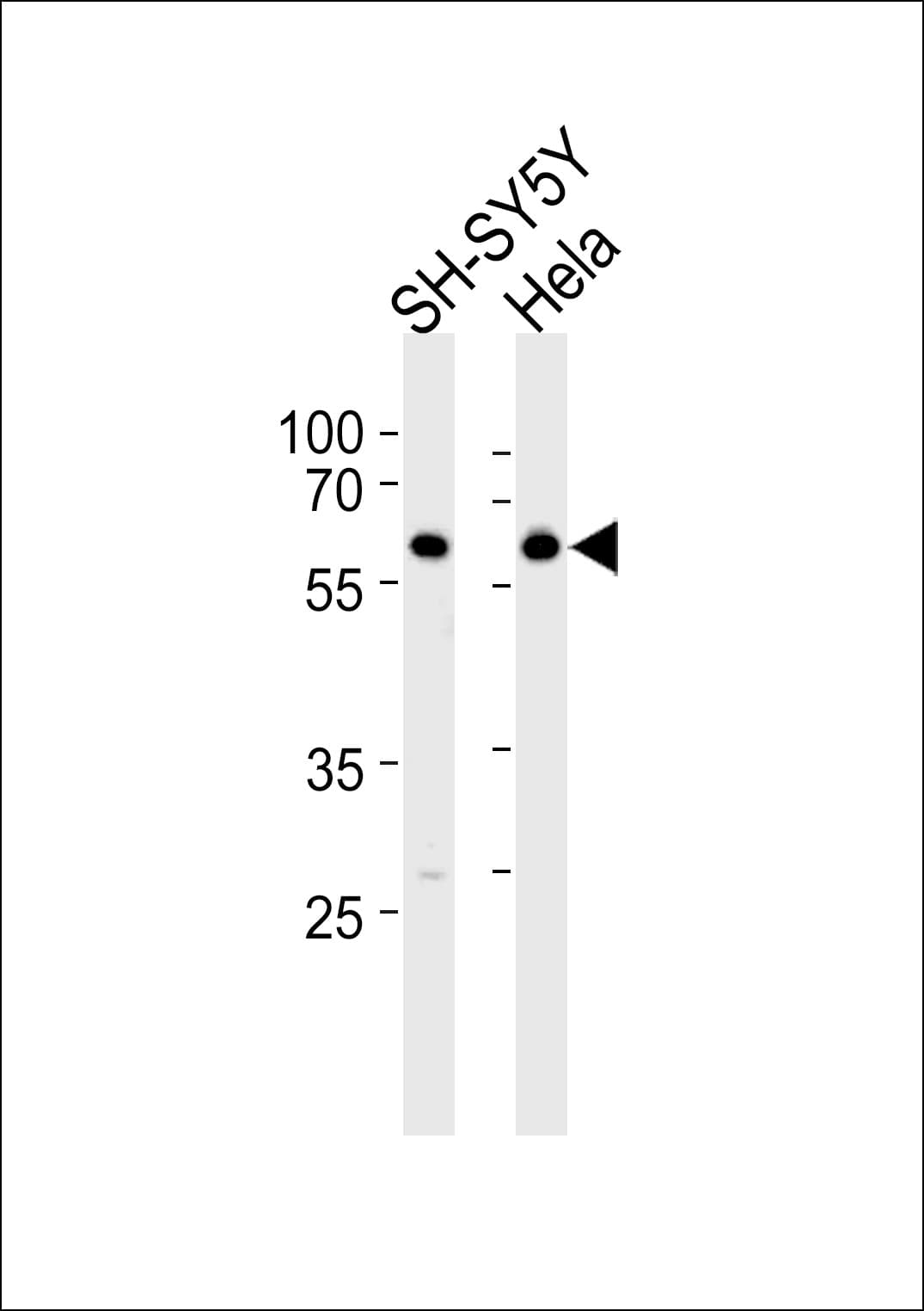 Polyclonal Rabbit anti-Human HDAC2 Antibody (aa410-439, IHC, IF, WB)