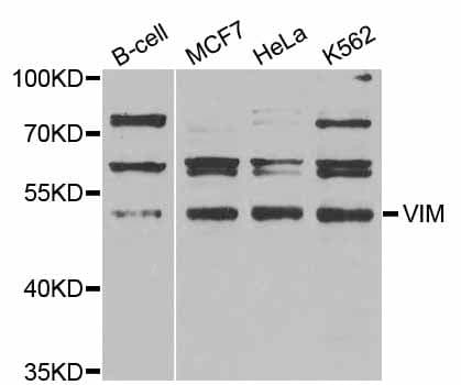 Vimentin Antibody