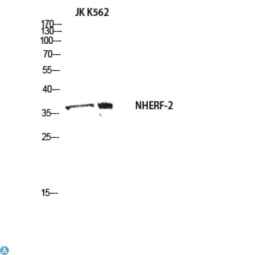 SLC9A3R2 / SIP1 Antibody