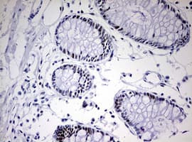 CD5 Antibody (clone OTI10F4)