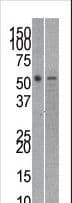 Polyclonal Rabbit anti-Human TIP48 / RUVBL2 Antibody (aa400-430, WB)