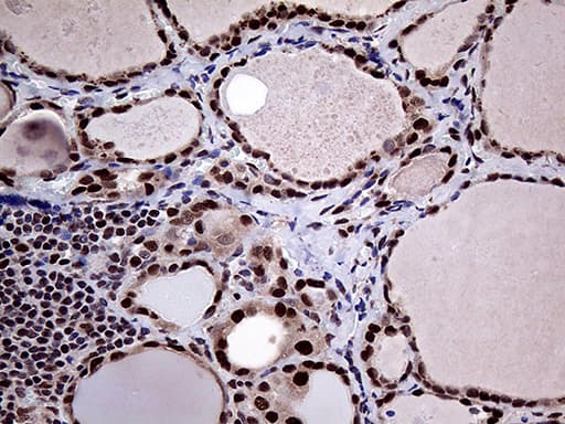 PPP4C Antibody (clone OTI2E4)