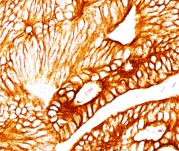 Monoclonal Mouse anti-Human KRT8 / CK8 / Cytokeratin 8 Antibody (clone K8.8, Ready-to-Use, IHC)