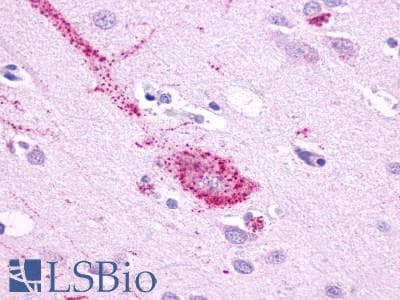 PathPlus™ GPR61 Antibody (N-Terminus)