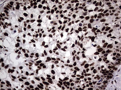 Monoclonal Mouse anti-Human HNRNPL / hnRNP L Antibody (clone OTI9G7, aa270-502, IHC, WB)