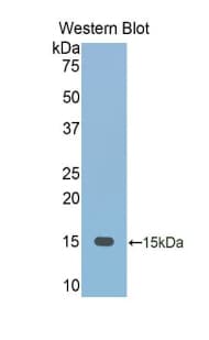FETUB / Fetuin B Antibody (aa152-261, FITC)