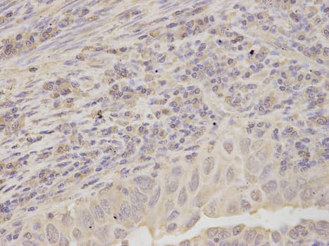 RPLP0 Antibody