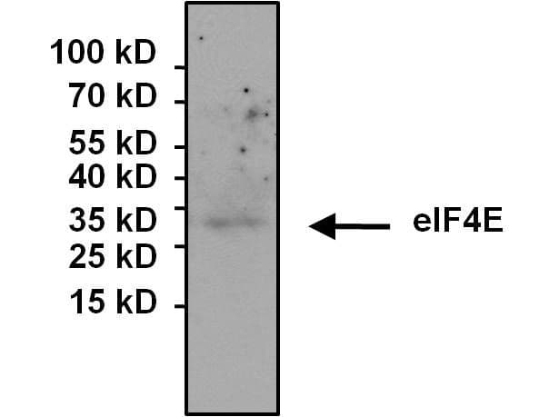 Monoclonal Mouse anti-Human EIF4E Antibody (clone 5D11, IF, WB)