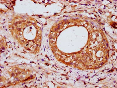 Polyclonal Rabbit anti-Human IRX6 Antibody (IHC, WB)