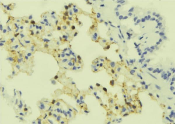 Polyclonal Rabbit anti-Human SSTR4 Antibody (IHC, WB)
