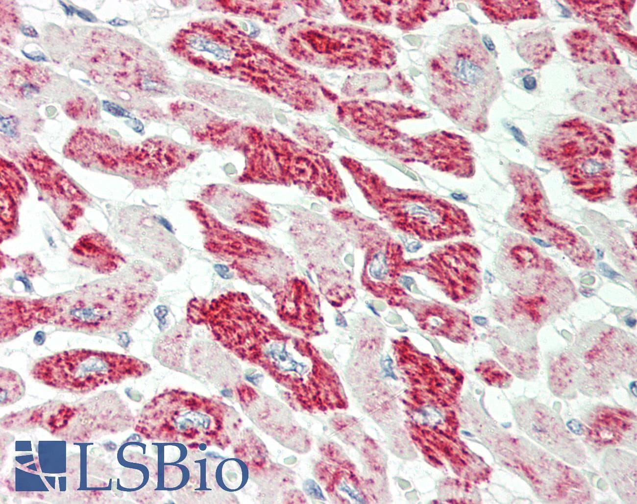 IHC-plus™ Polyclonal Rabbit anti-Human VDAC1 / PORIN Antibody (aa1-30, IHC, WB)