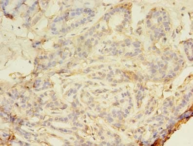 SMAD1 Antibody