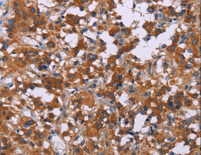 ERK1 + ERK2 Antibody