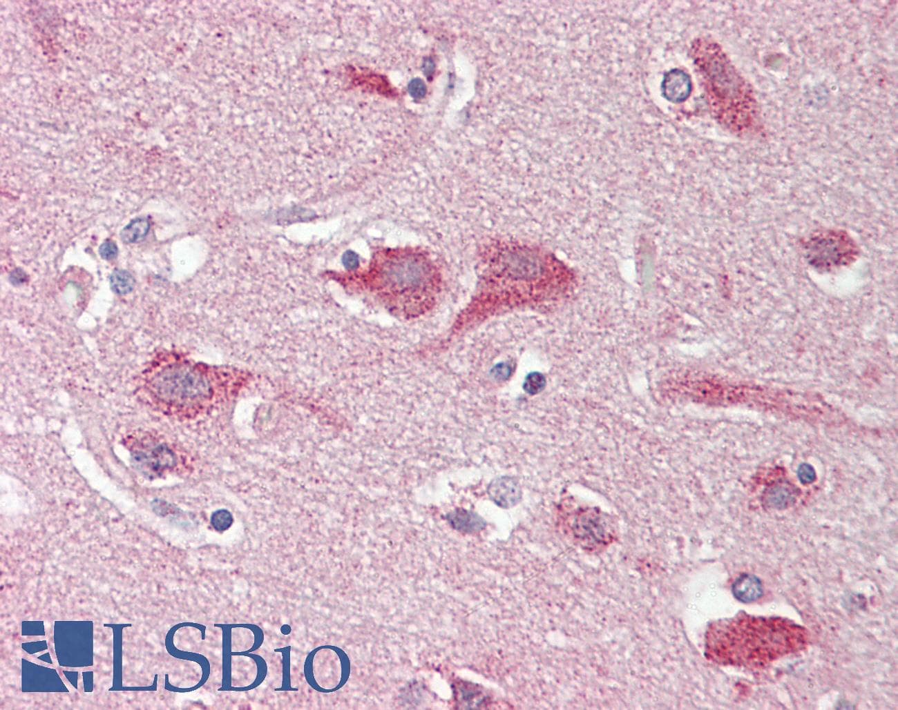 IHC-plus™ Polyclonal Rabbit anti-Human OPCML / OBCAM Antibody (IHC, WB)