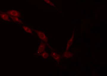 Polyclonal Rabbit anti-Human NDUFV2 Antibody (IF, WB)