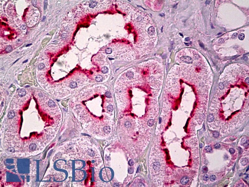 IHC-plus™ GPCR6 / GPR101 Antibody (aa451-500)