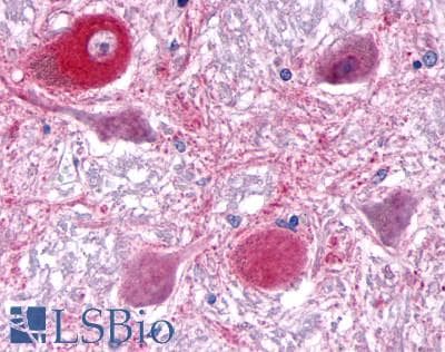 PathPlus™ Polyclonal Rabbit anti-Human RORA / ROR Alpha Antibody (Ligand-binding Domain, IHC)