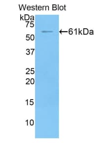 FGL1 / Hepassocin Antibody (aa23-314)
