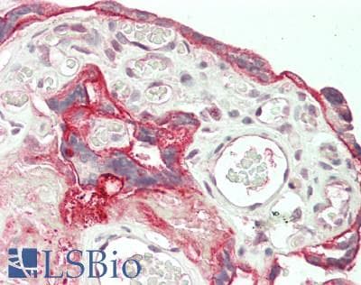 IHC-plus™ Polyclonal Rabbit anti-Human NT5E / eNT / CD73 Antibody (IHC, IF, WB)