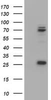 Monoclonal Mouse anti-Human CNOT4 / CLONE243 Antibody (clone OTI1F9, aa190-455, WB)