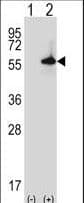 Polyclonal Rabbit anti-Mouse SGK3 Antibody (aa381-409, WB)