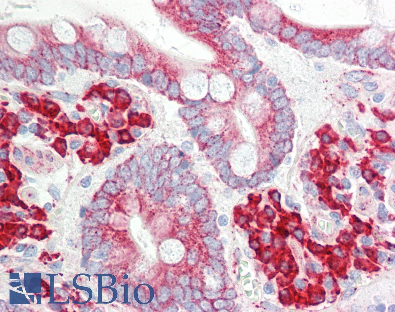 PathPlus™ Polyclonal Rabbit anti-Human ETFA Antibody (aa276-304, IHC, WB)