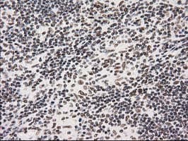 PRKCE / PKC-Epsilon Antibody (clone OTI4B3, Carrier-free)
