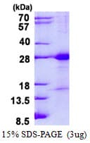 Human JAM3 Protein (Recombinant His)