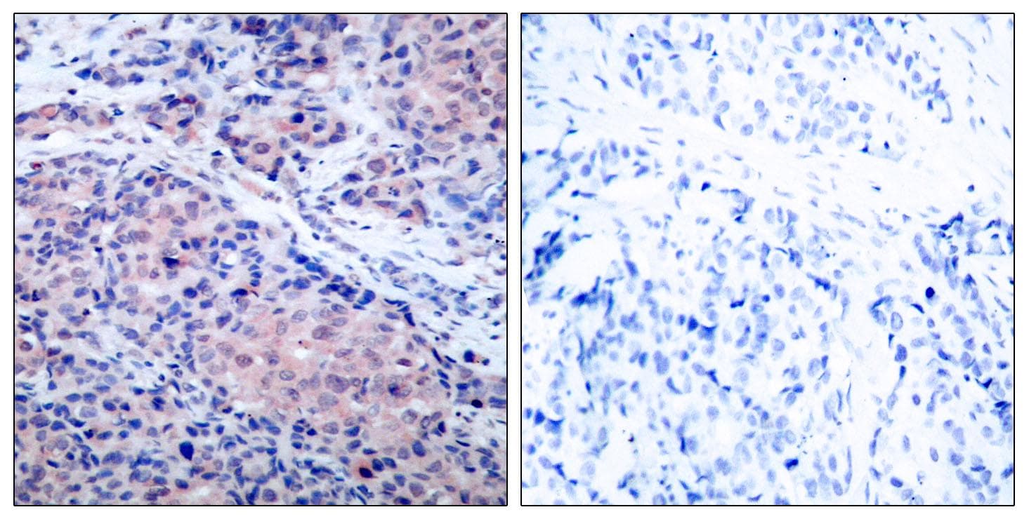 Polyclonal Rabbit anti-Human NFKBIA / IKB Alpha / IKBA Antibody (p32/36, IHC, WB)