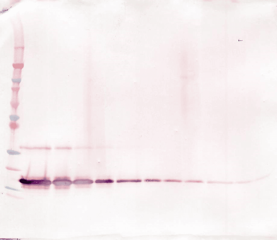IHC-plus™ Polyclonal Rabbit anti-Human TNFRSF1B / TNFR2 Antibody (IHC, WB)