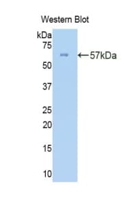 COL3A1 / Collagen III Antibody (aa1059-1466, Biotin)
