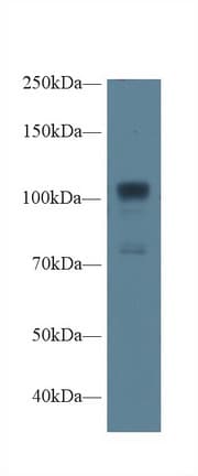 NOS1 / nNOS Antibody (aa468-616)