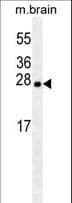 Latexin / MUM Antibody