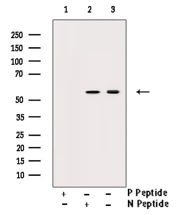 CHEK1 / CHK1 Antibody (phospho-Ser301)