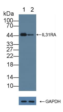 Polyclonal Rabbit anti-Human IL31RA Antibody (aa205-456, WB)