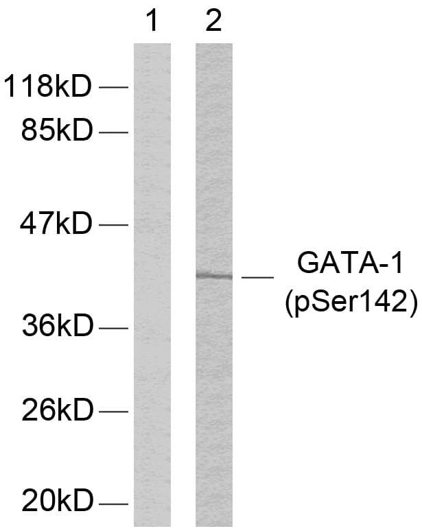 Polyclonal Rabbit anti-Human GATA1 Antibody (phospho-Ser142, IHC, WB)