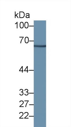 RPN1 / Ribophorin I Antibody (aa24-179, PE)