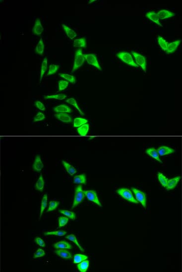 Polyclonal Rabbit anti-Human AK1 / Adenylate Kinase 1 Antibody (IHC, IF, WB)