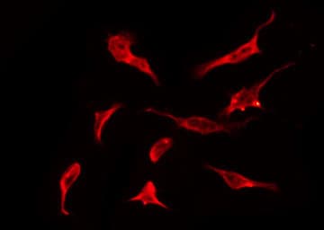 Polyclonal Rabbit anti-Human OR2K2 Antibody (IF, WB)