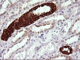 Monoclonal Mouse anti-Human TRIM45 Antibody (clone OTI2B11, aa288-580, IHC, WB)
