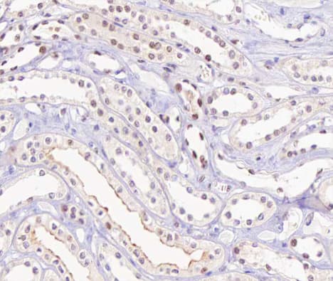 Polyclonal Rabbit anti-Human RB1 / Retinoblastoma / RB Antibody (phospho-Ser780, IHC, IF, WB)